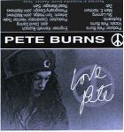 pete burns